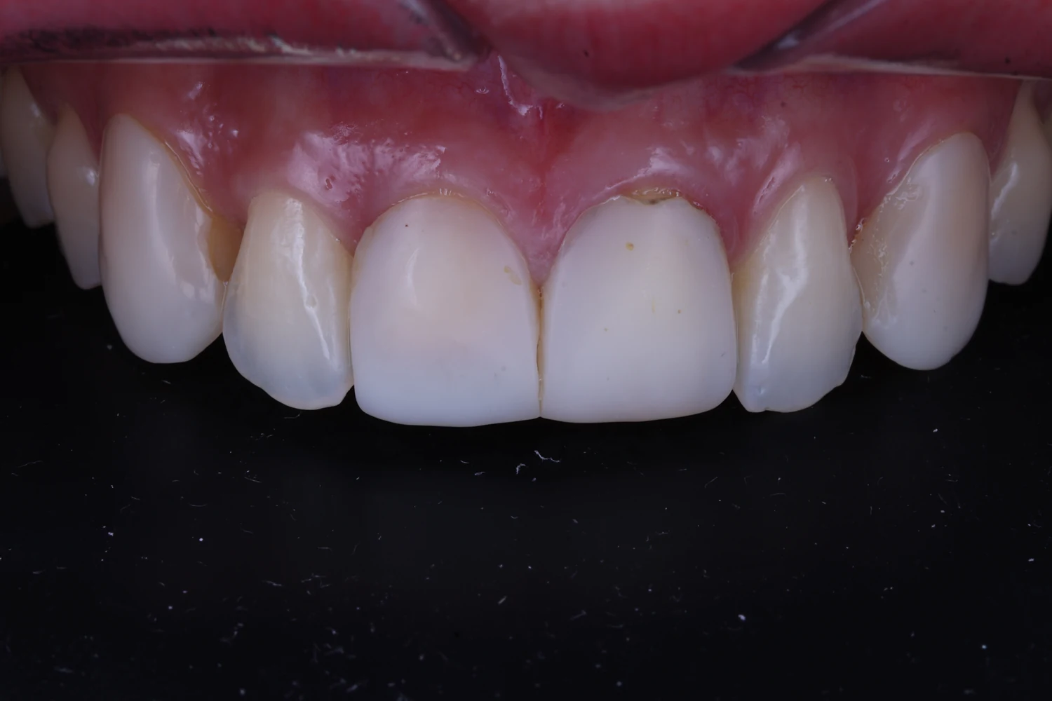 Comparativa 01: antes