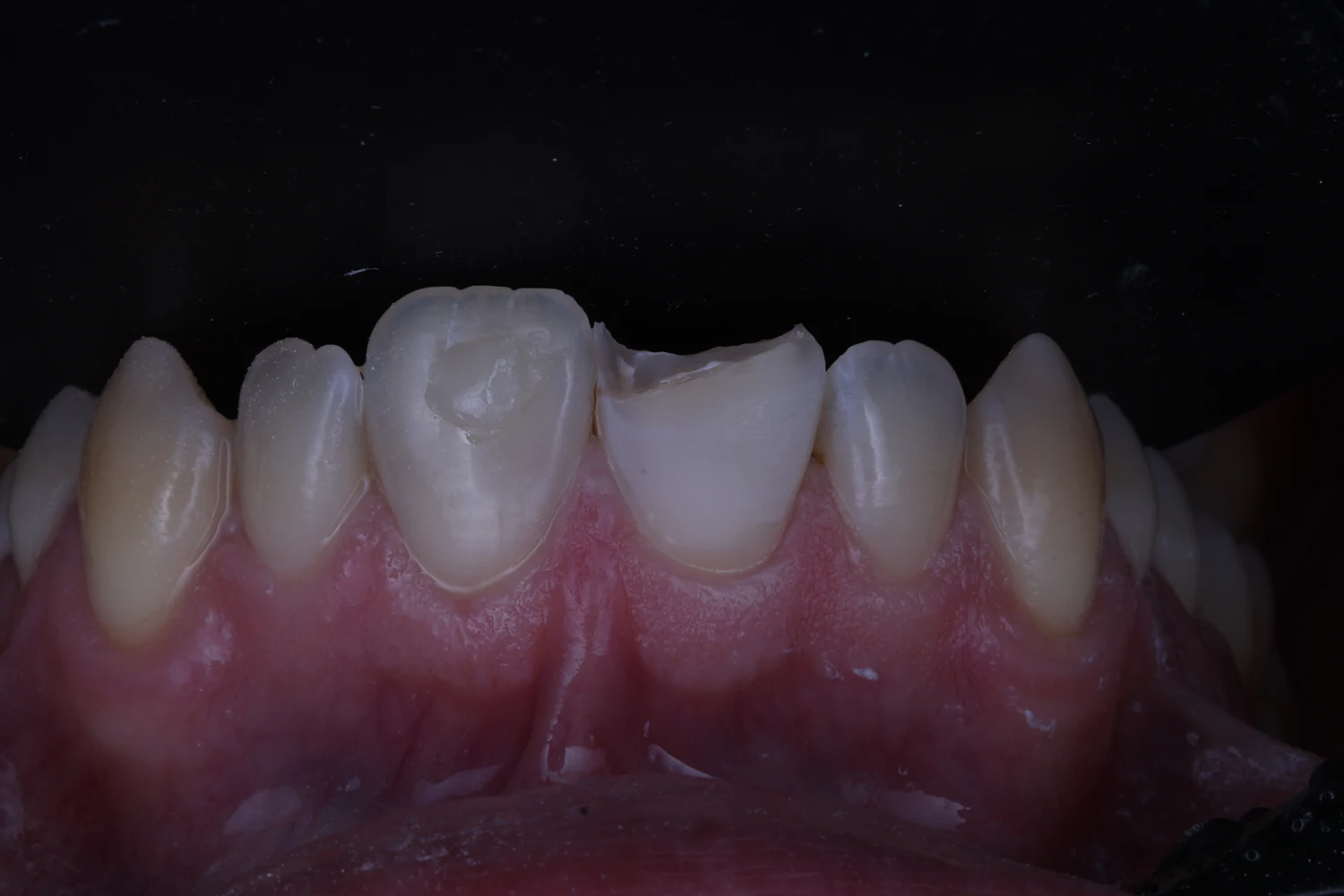 Comparativa 03: antes