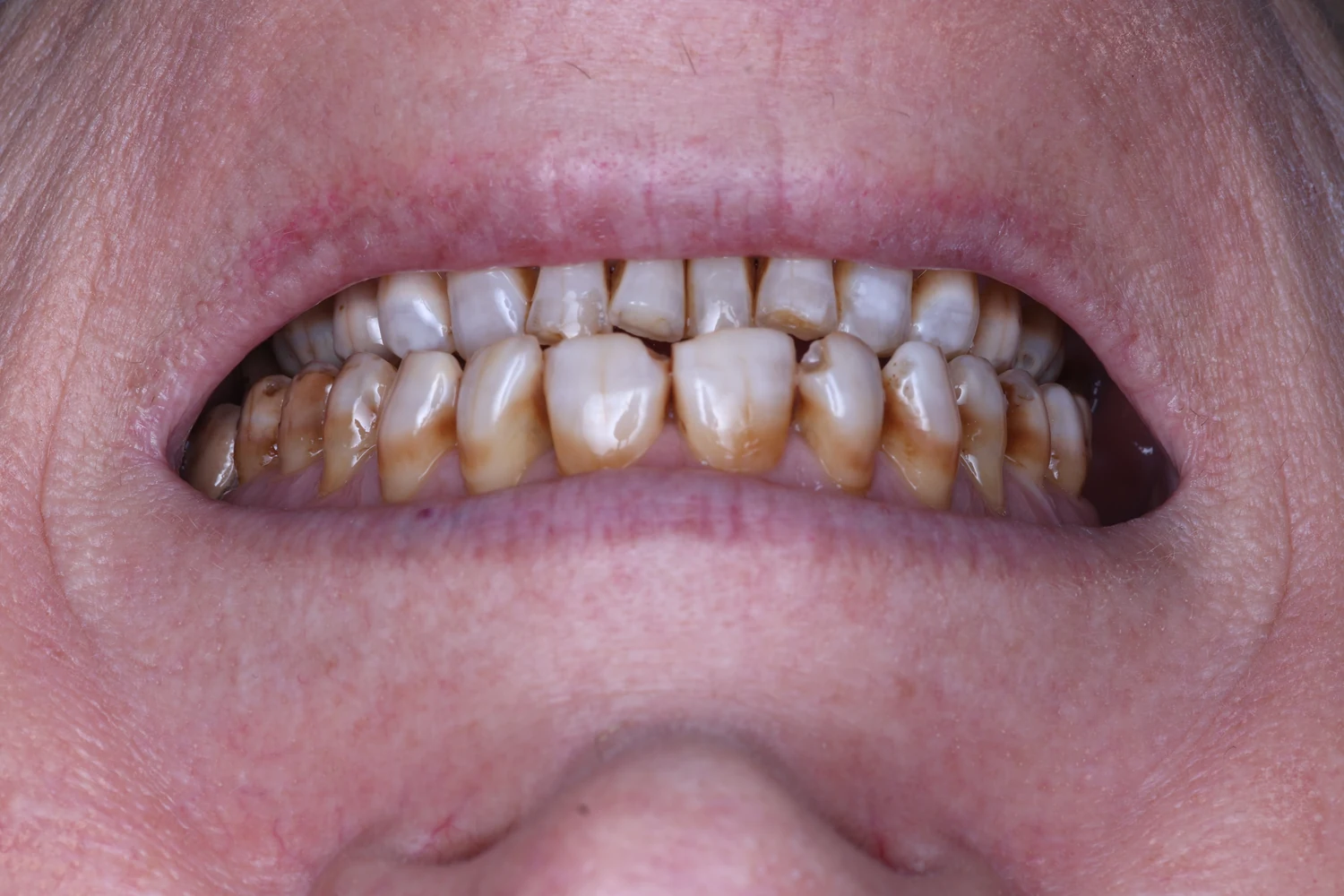Comparativa 05: antes
